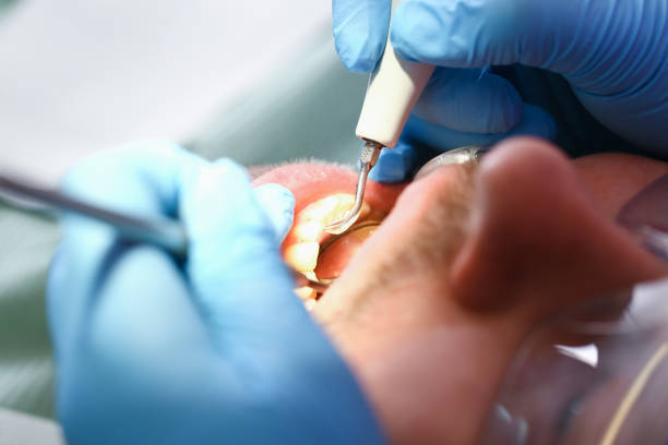 Best Emergency Root Canal Treatment in Kensett, AR